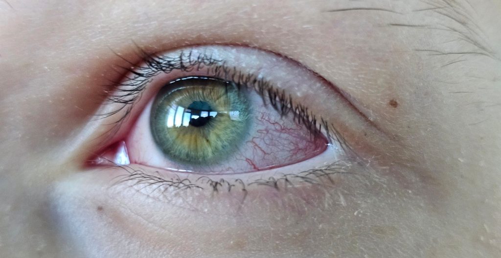 greffe-cornee-bordeaux-specialiste